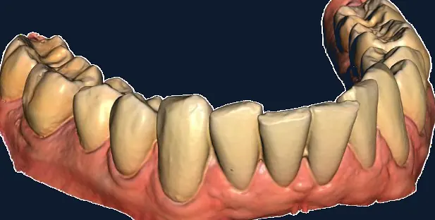 Digitaler Abdruck einer Zahnreihe als 3D-Modell